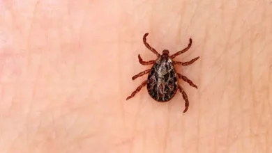 Sivas'ta KKKA şüphesiyle tedavi gören kadın hayatını kaybetti